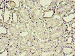 GSN Antibody
