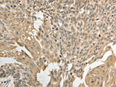 GSR Antibody