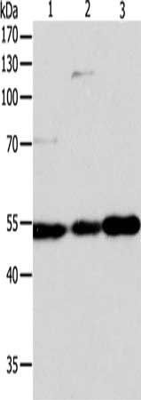GSR Antibody