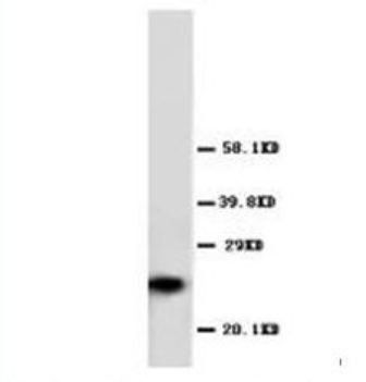 GST3/GST pi/GSTP1 Antibody