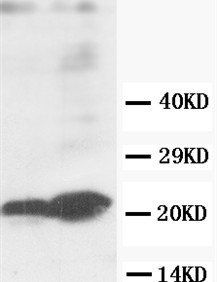 GST3/GST pi/GSTP1 Antibody