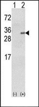 GSTA1 antibody