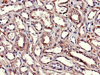 GSTA1 Antibody