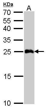 glutathione S-transferase alpha 1 Antibody