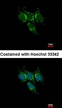 GSTA1 Rabbit Polyclonal Antibody