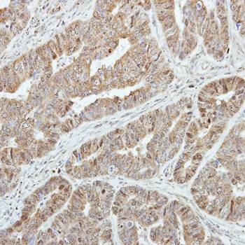 GSTA1 Rabbit Polyclonal Antibody