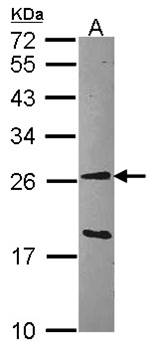 GSTA1 Rabbit Polyclonal Antibody