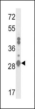 GSTA2 antibody