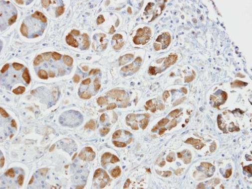 GSAT1 / GSAT2 / GSAT3 antibody