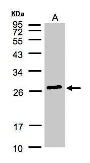 GSTA2 antibody