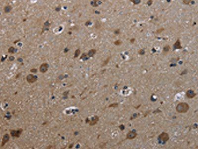 GSTA3 Antibody