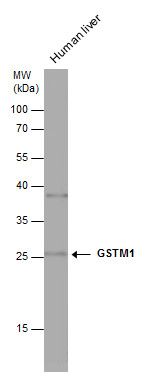 glutathione S-transferase mu 1 Antibody