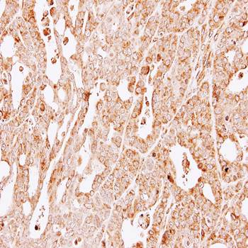 GSTM1 antibody