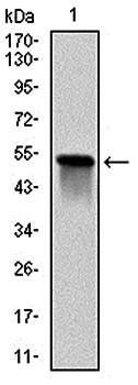 GSTM1 Antibody