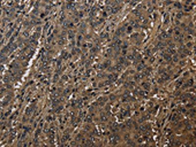 GSTO1 Antibody