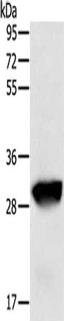 GSTO1 Antibody