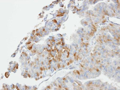glutathione S-transferase omega 1 Antibody