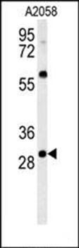 GSTO2 antibody