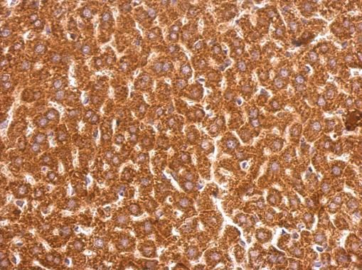 GSTP1 antibody