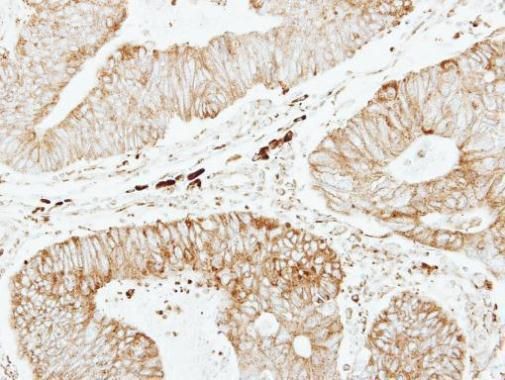 GSTP1 antibody [N1N2], N-term