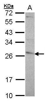 GSTP1 antibody [N1N2], N-term