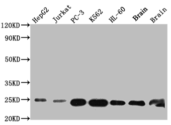 GSTP1 Recombinant Monoclonal Antibody