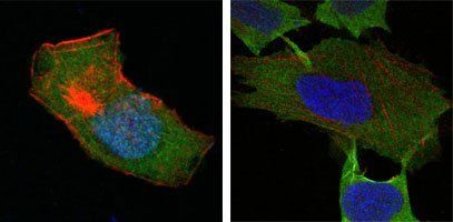 GSTP1 Antibody