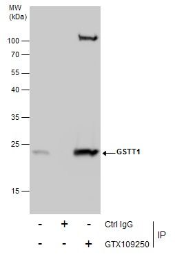 glutathione S-transferase theta 1 Antibody