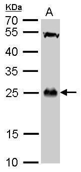 glutathione S-transferase theta 1 Antibody