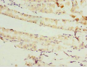 GSTZ1 Antibody