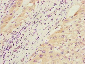 GTF2A2 Antibody