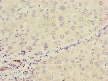 GTF2A2 Antibody
