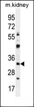 GTF2B antibody