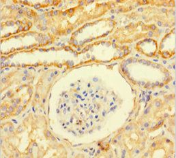 GTF2F1 Antibody