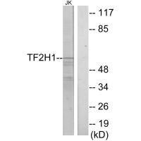 GTF2H1 antibody