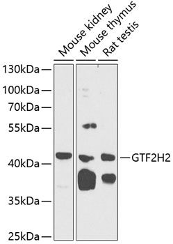 GTF2H2 antibody