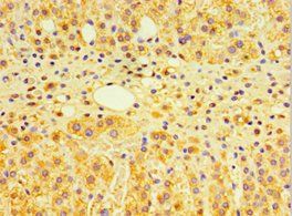 GTF2H2C Antibody