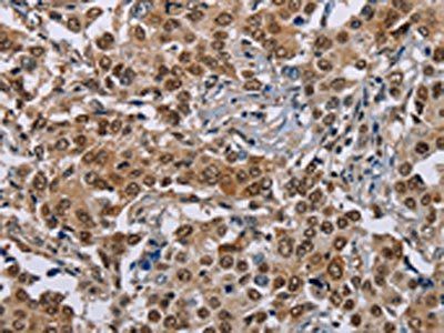 GTF2I Antibody