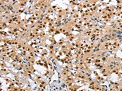 GTF2I Antibody