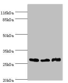 Gamt Antibody