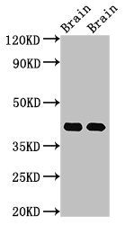 Guanine nucleotide-binding protein G(o) subunit alpha antibody