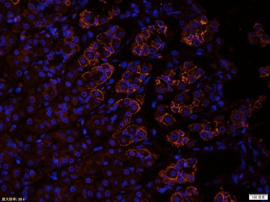 Guanylate Cyclase beta1 subunit antibody