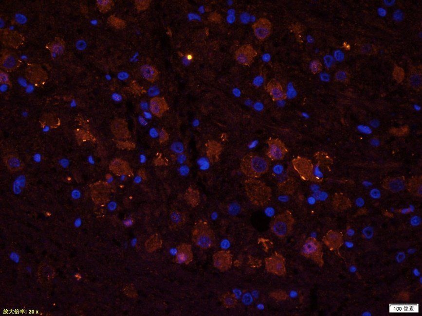 Guanylate Cyclase beta1 subunit antibody