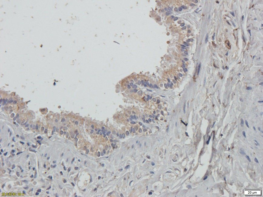 Guanylate Cyclase beta1 subunit antibody