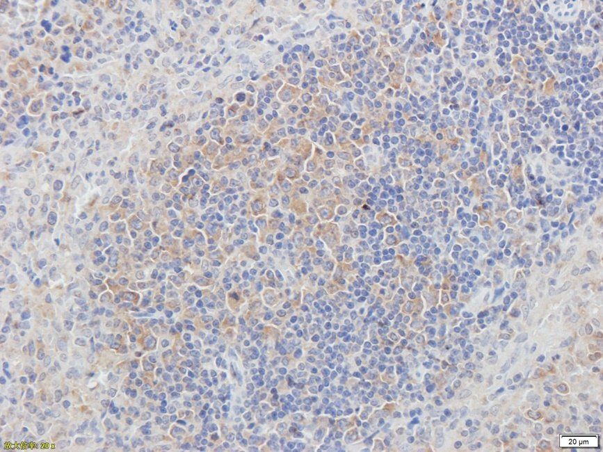 Guanylate Cyclase beta1 subunit antibody