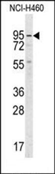 Guanylyl Cyclase alpha 2 antibody