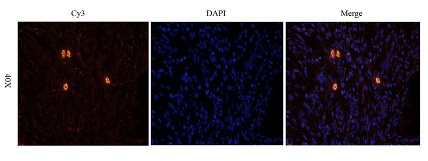 GUCY1A2 antibody