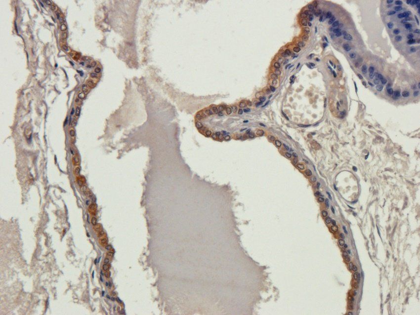 GUCY1A2 antibody