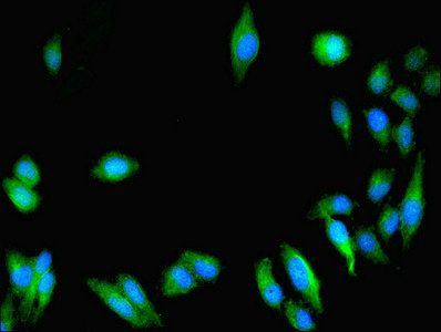 GUCY1A1 Antibody