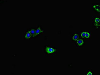 GUCY1A1 Antibody
